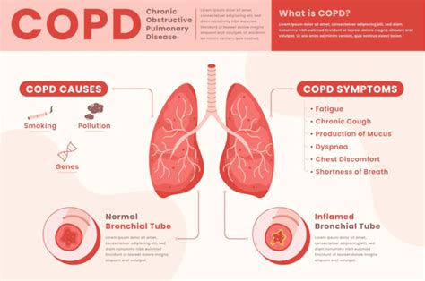 COPD: Chronic Obstructive Pulmonary Disease — We Care Home Health