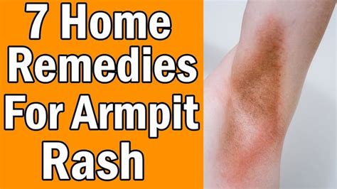 7 Home Remedies For Armpit Rash in 2020 | Armpit rash, Home remedies, Rashes remedies