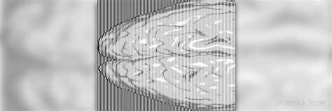 Hemispherectomy: Brain surgery to remove part of the brain | Nervous System Disorders and ...