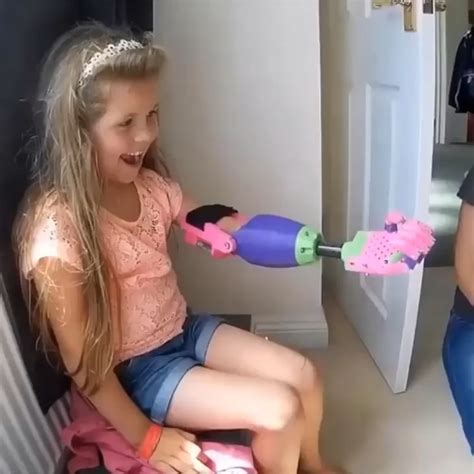 These Highly Affordable Prosthetic Limbs For Children... : r/MadeMeSmile