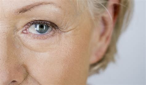 Study suggests serum improves under-eye wrinkles - Aesthetics