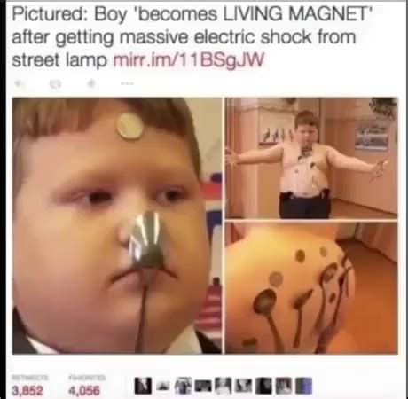 Pictured: Boy 'becomes LIVING MAGNET' after getting massive electric shock from street lamp - iFunny