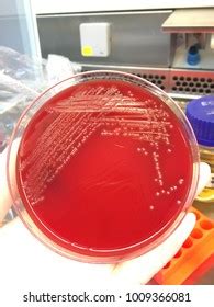 Pathogenic Bacteria On Blood Agar Stock Photo 1009366081 | Shutterstock