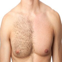 5 Top Methods Of Chest Hair Removal | Depilacion brasileña, Depilacion