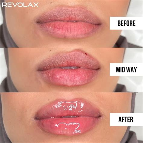 REVOLAX Before and After Transformations - REVOLAX UK