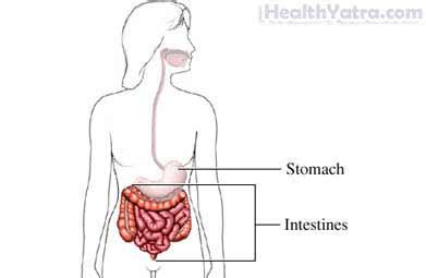 Malabsorption Definition, Causes, Symptoms, Complications and Cost Surgery Treatment Hospital in ...