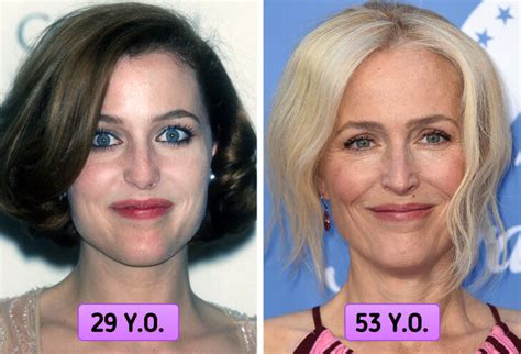 Gillian Anderson Plastic Surgery: Before and After | PlasticSurgeryInsights.com