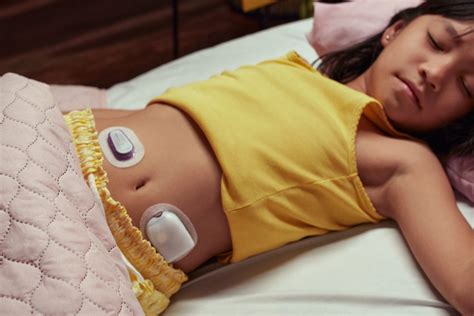 How the Omnipod 5 - The Tubeless Closed-Loop Insulin Pump - Plans to ...