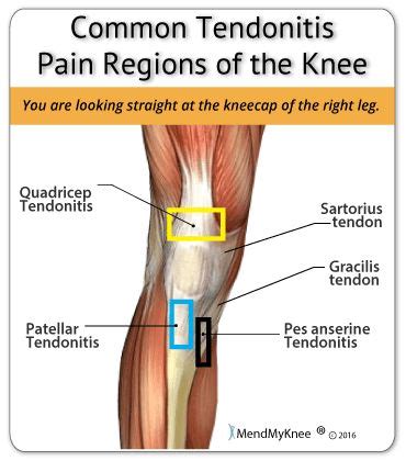 All about Knee Pain | Universal Health Products