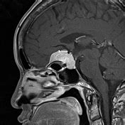 Playlist 'NeuroradiologyRIPAS - teaching cases' by Dr Ian Bickle