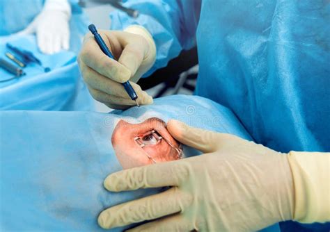 The Operation on the Eye. Cataract Surgery. Stock Photo - Image of inside, clinic: 184010666