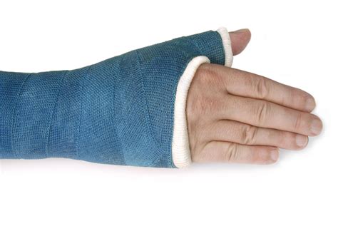 Scaphoid Fracture - Raleigh Hand Surgery — Joseph J. Schreiber, MD