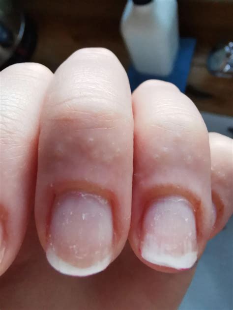 Experts warn of ‘life-long’ effects of nail gel polish
