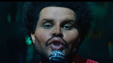 Did The Weeknd Have Plastic Surgery? His New Look Explained