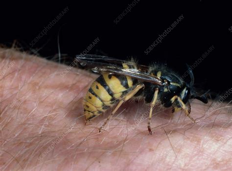 Common wasp stinging human - Stock Image - Z345/0224 - Science Photo ...