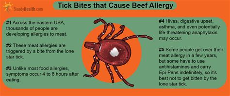 Do You Have A Beef With The Lone Star Tick? Tick Bite Causes Meat Allergy | Allergies articles ...