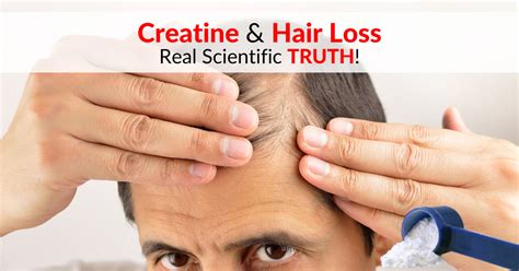 👨‍🦲 Creatine & Hair Loss - Real Scientific TRUTH For 2024