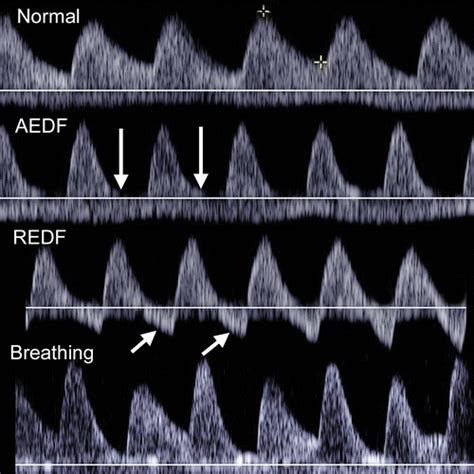 A Radiologist’s Guide to the Performance and Interpretation of ...