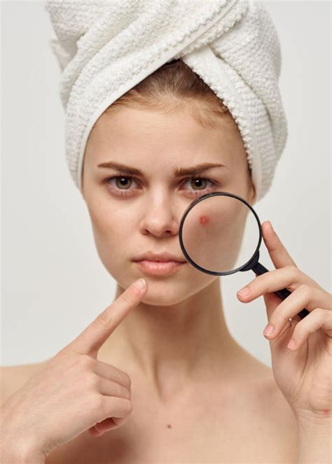 Does Hyaluronic Acid Help Acne Scars?