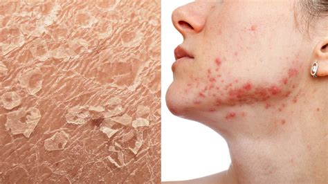 Dermatologists Reveal 5 Signs of Stressed Skin (And How to Heal It)