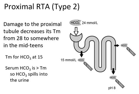 Figure-3-proximal-renal-tubular-acidosis-type-2-RTA-Joel-Topf - The ...