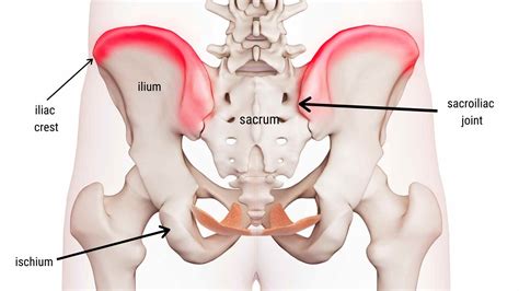 Iliac Crest Pain Syndrome – Causes and Treatment - Spinal Backrack