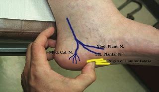 physiotherapy blogging: Entrapment of medial calcaneal nerve (MCN ...