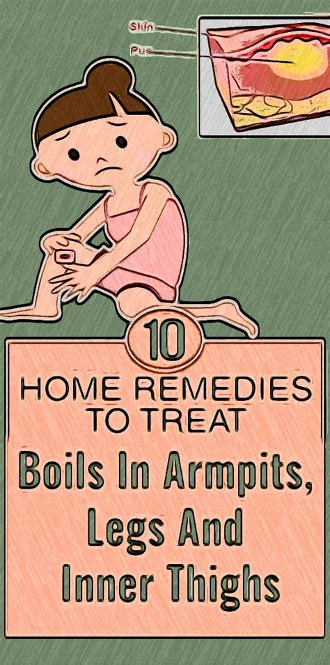 10 Quick Home Remedies To Cure Boils In Armpits, Legs And Inner Thighs ...