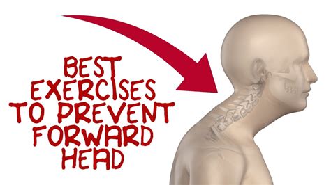 Forward Head Exercises to Fix Forward Head Posture - YouTube