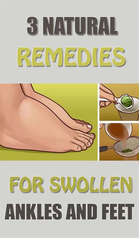 3 Natural remedies for swollen ankles and feet | Colds ,flu,healing and ...