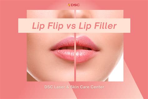 Lip Flip vs Lip Filler - DSC Laser & Skin Care Center