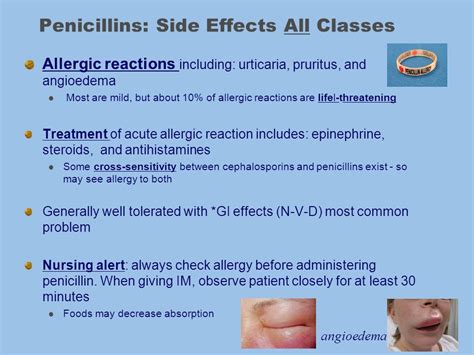 Penicillins: Side Effects - Antibiotic Drugs - AntiinfectiveMeds.com