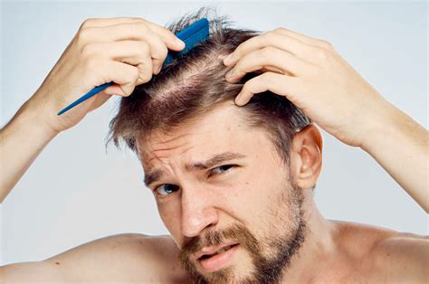 Thinning hair: why it happens and how to deal with it - myhair