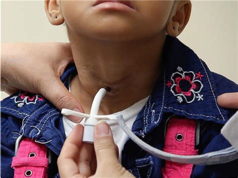 ALERT: How to be prepared to perform an emergency trach change? — Connected Care @ SickKids