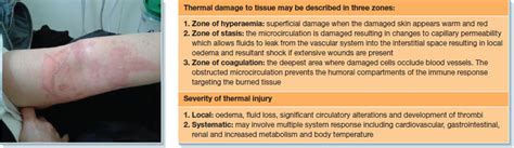 Thermal injuries | Nurse Key