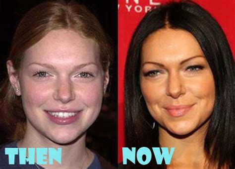 Laura Prepon Plastic Surgery Before and After Photos - Lovely Surgery | Celebrity Before and ...