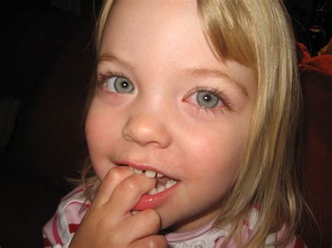 New Beauty News: pink eye symptoms in children