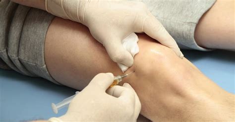 Injections for Knee Pain: Understand Your Options: ISP Health PLLC - Integrated Solutions for ...