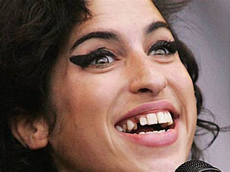 Amy Winehouse hospitalized after fainting in London home | MusicRadar