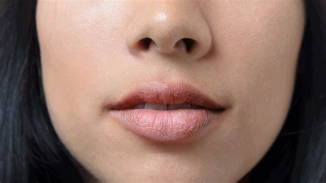 Swollen Lips And Rash On Face | Lipstutorial.org