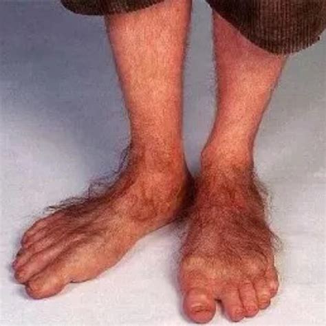 Crusty Feet