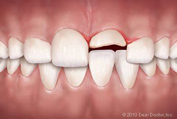 Facial Trauma and Reconstructive Surgery - NKC Dental