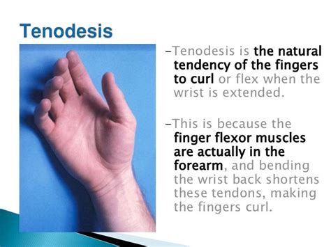 Assistive Technologies Glove Design