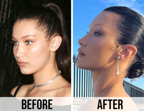 Bella Hadid Then & Now: See How Much Her Face Has Changed Over The ...