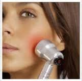 Chemical Peels for Acne and Anti Aging: Baby Quasar Light Therapy