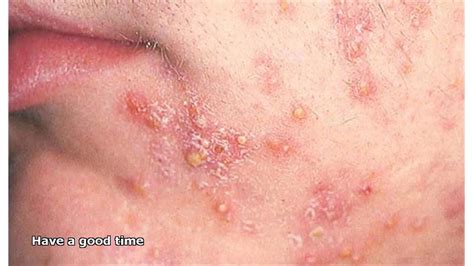 Common Skin Diseases And Conditions Explained - vrogue.co