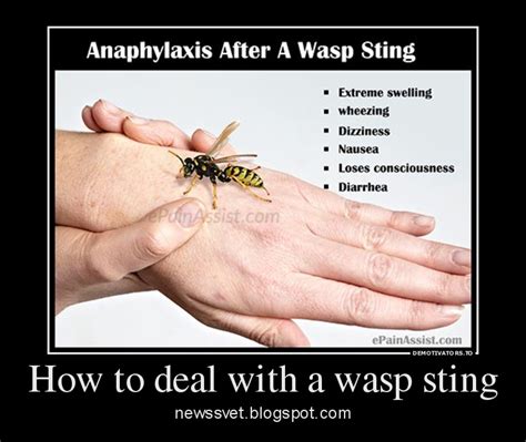 How to deal with a wasp sting | News of the World Top Hollywood Celebrity