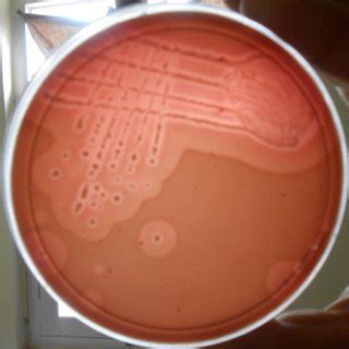 Pure culture of Clostridium perfringens on Sulphite Polymixin ...