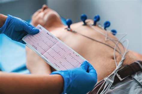 Electrocardiogram,,Ecg,In,Hand.,Cardiogram,Printout,On,Male,Patient,Background | Wockhardthospitals