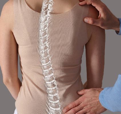 We trust that spine implants are safe… - SPINEMarketGroup